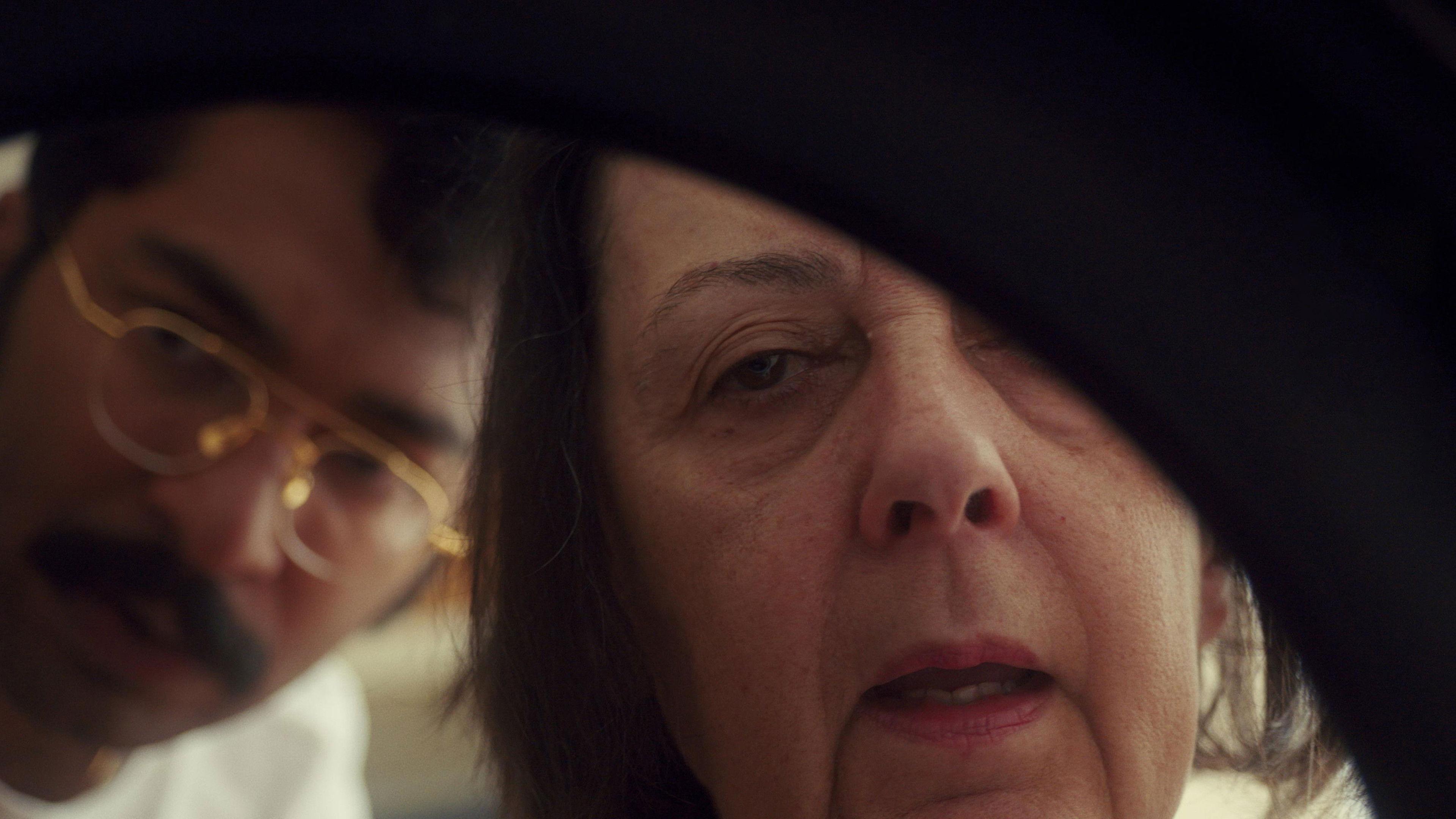 Removal of the Eye Preview